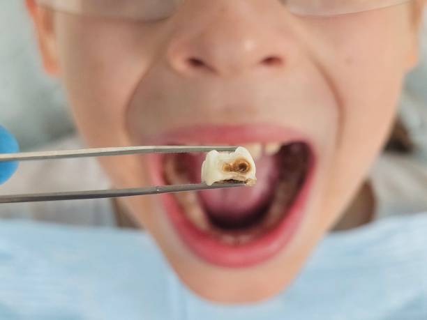 Best Emergency Dental Care for Sports Injuries in Ferron, UT